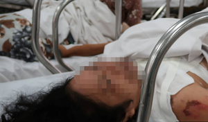 Cuồng ghen, cụ ông 70 tuổi tạt axit vào mặt người tình kém 22 tuổi