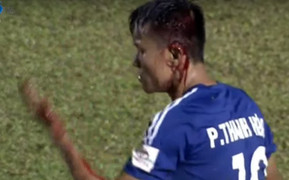 Cầu thủ Quảng Nam đầu bê bết máu sau va chạm với trung vệ HAGL