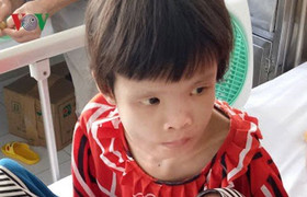 Xót xa hình ảnh da bọc xương của bé gái 15 tuổi mắc bệnh lạ