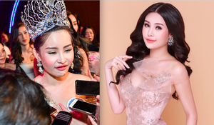 Tân Hoa hậu Đại dương bị chê 'thảm hoạ thẩm mỹ', khác xa ảnh photoshop long lanh