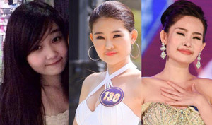 Rò rỉ hình ảnh tân Hoa hậu Đại dương trước khi can thiệp thẩm mỹ