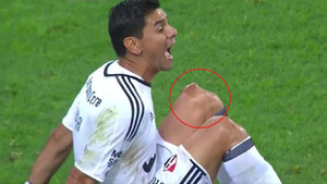 Thủ môn ôm gối khóc òa trên sân sau chấn thương khủng khiếp