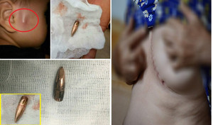 Phó Thủ tướng chỉ đạo làm rõ vụ đạn lạc 5 lần trong 4 tháng ở Vĩnh Phúc