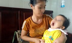 Bị côn trùng đốt, bé gái bị teo não, co quắp chân tay