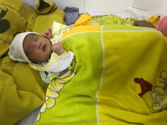 Nhỏ sữa mẹ để chữa đau mắt, em bé suýt thủng giác mạc