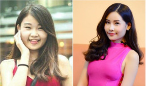 'Hoa hậu Đại dương từng sửa mũi thì không còn là vẻ đẹp tự nhiên'