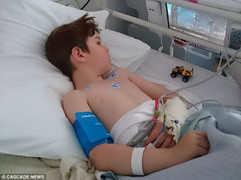 Xót xa bé 6 tuổi bị bại não, liệt mặt chỉ vì một vết cắn nhỏ