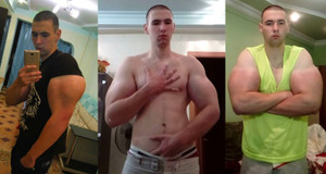 Tiêm chất tăng cơ bắp để có bắp tay 60cm, thanh niên 21 tuổi suýt mất mạng