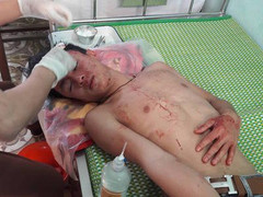 Côn đồ xông vào trường gây rối, thầy giáo và học sinh nhập viện cấp cứu