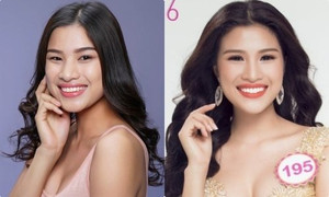 Nếu tháo bọc răng sứ, hàm răng của Nguyễn Thị Thành trông sẽ thế nào?