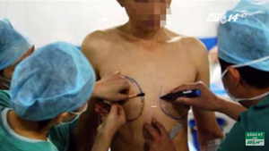 Gần 300.000 người Việt mong muốn chuyển giới