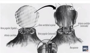 Ca ghép đầu người ở Trung Quốc: Thử nghiệm thành công, chuẩn bị ghép trên người sống