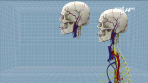 Bác sỹ tuyên bố ghép đầu người thành công bị chỉ trích dữ dội