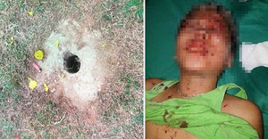 Vật lạ phát nổ ở Thái Nguyên, 4 học sinh thương nặng