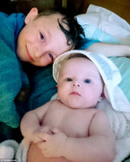 Viêm màng não nguy hiểm tới nỗi trẻ phải cắt bỏ tay chân nếu mắc phải