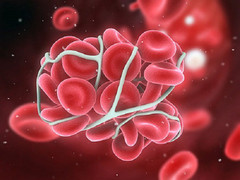 Tìm ra thuốc chữa hoàn toàn bệnh ung thư máu?