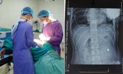 Truy bắt đối tượng nổ súng bắn cô gái thủng bụng ở Hà Nội