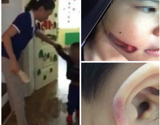 Những vụ bạo hành trẻ em khiến dư luận phẫn nộ thời gian qua