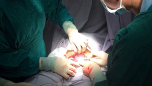 Sợ hãi với vết sẹo sau sinh mổ, mẹ bỉm sữa cầu cứu dân mạng