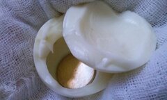 Hoảng hồn với phương pháp cạo gió cắt sốt cho con truyền tai nhau của các mẹ bỉm sữa