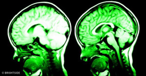 7 cách khiến não bộ hạnh phúc hơn