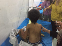 Cha ruột nhậu say, đánh đập dã man bé trai 11 tuổi