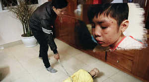 Bé trai 10 tuổi bị bố đẻ bạo hành: 'Ngoài người cha, còn thấy sự vô trách nhiệm của chính quyền địa phương’