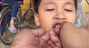 Clip: Chết cười với cách nhổ răng bằng xe máy đầy sáng tạo của ông bố Ninh Bình