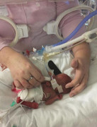 Nghẹn ngào câu chuyện người mẹ sinh non ở tuần 29 với 30% cơ hội sống sót