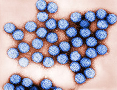 Cảnh báo virus gây tiêu chảy cấp đang lan rộng, gây nguy hiểm cho bé