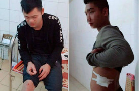 Nhóm côn đồ Nam Định rút súng bắn lái và phụ xe khách, đâm trọng thương chủ xe