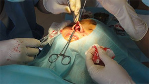 Cận cảnh bác sĩ rạch mũi, độn silicon làm đẹp cho chị em