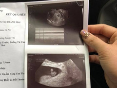 Sản phụ Hà Nội 'tố' bác sĩ tắc trách suýt phải bỏ thai: Bộ Y tế chỉ đạo xử lý nghiêm