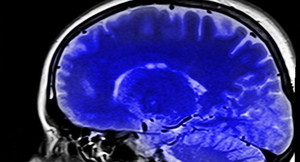 Tìm ra bí quyết giúp não bộ luôn minh mẫn