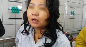 Hôn mê sâu, suy gan sau khi uống thực phẩm giảm cân