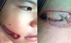 Những vụ bạo hành trẻ em rúng động dư luận
