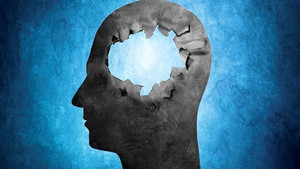 Giải mã thế nào với cả trăm con người vẫn sống bình thường dù không có não?