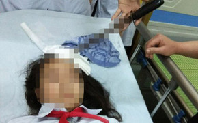 Bộ GD-ĐT yêu cầu xử lý nghiêm vụ nam sinh phóng dao cắm vào trán bạn