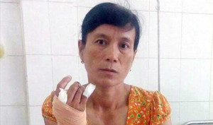 Đánh hàng xóm, thư ký tòa bị tù treo, cho ra khỏi ngành