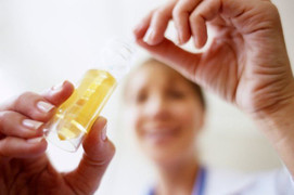 Xét nghiệm nước tiểu có thể dự đoán được cái chết