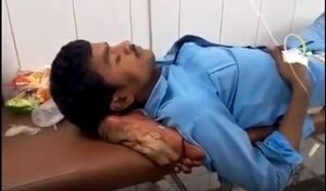 Clip: Hãi hùng cảnh chiếc chân bị cắt rời được bác sĩ lấy làm gối đầu cho bệnh nhân