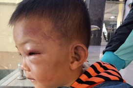 Bé trai 2 tuổi bị bạo hành dã man ở Nghệ An: Bố dượng thừa nhận đánh con riêng của vợ