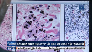 Phát hiện cơ quan nội tạng mới trong cơ thể con người