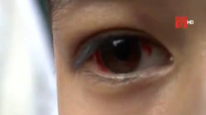 Mẹ kế bắt đi mua băng vệ sinh, bé trai mua sai loại bị đánh bầm tím, rách giác mạc