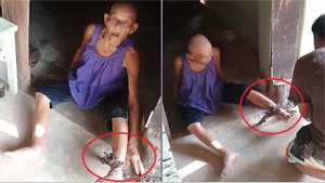 Clip: Cụ bà mắc Alzheimer bị xích chân đến bật máu trước cửa nhà