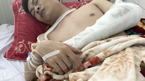 Hai thanh niên 'nhìn đểu' bị nhóm côn đồ vác mã tấu truy sát tận nhà