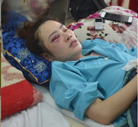 Hé lộ nhân thân nam thanh niên giành ăn bánh xèo đánh cô gái nhập viện