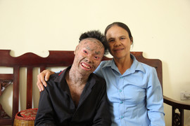 'Người cá' Ngô Văn Thọ: 'Có những lúc tủi, em ước là cá thật'