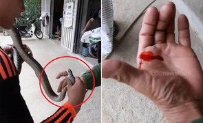 Clip: Trêu rắn, người đàn ông bị rắn cắn chảy máu tay