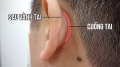 5 phút để tự cứu mạng khi bị tăng huyết áp đột ngột